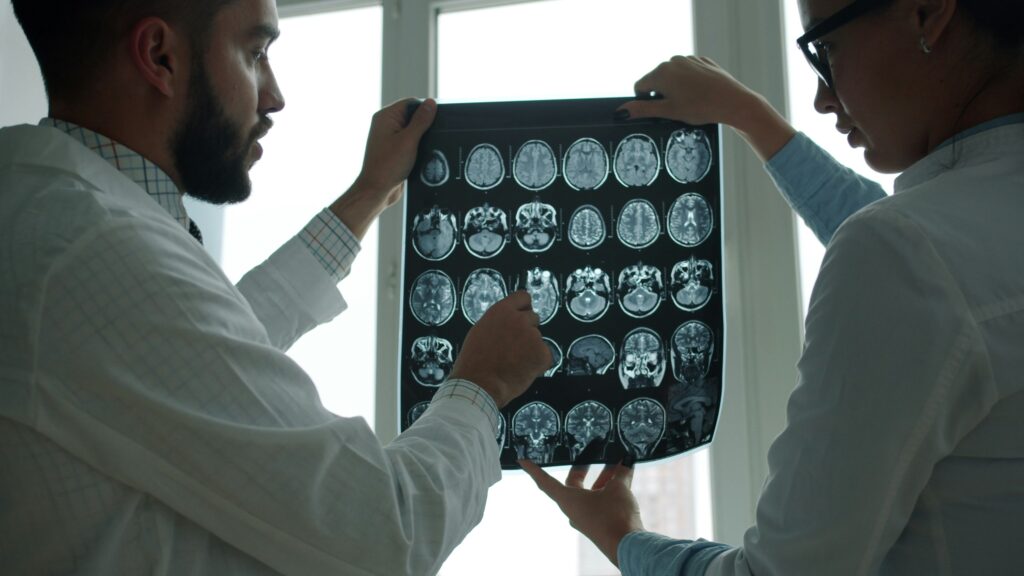 How a Wisconsin Traumatic Brain Injury Attorney Helps You Recover After a Head Injury